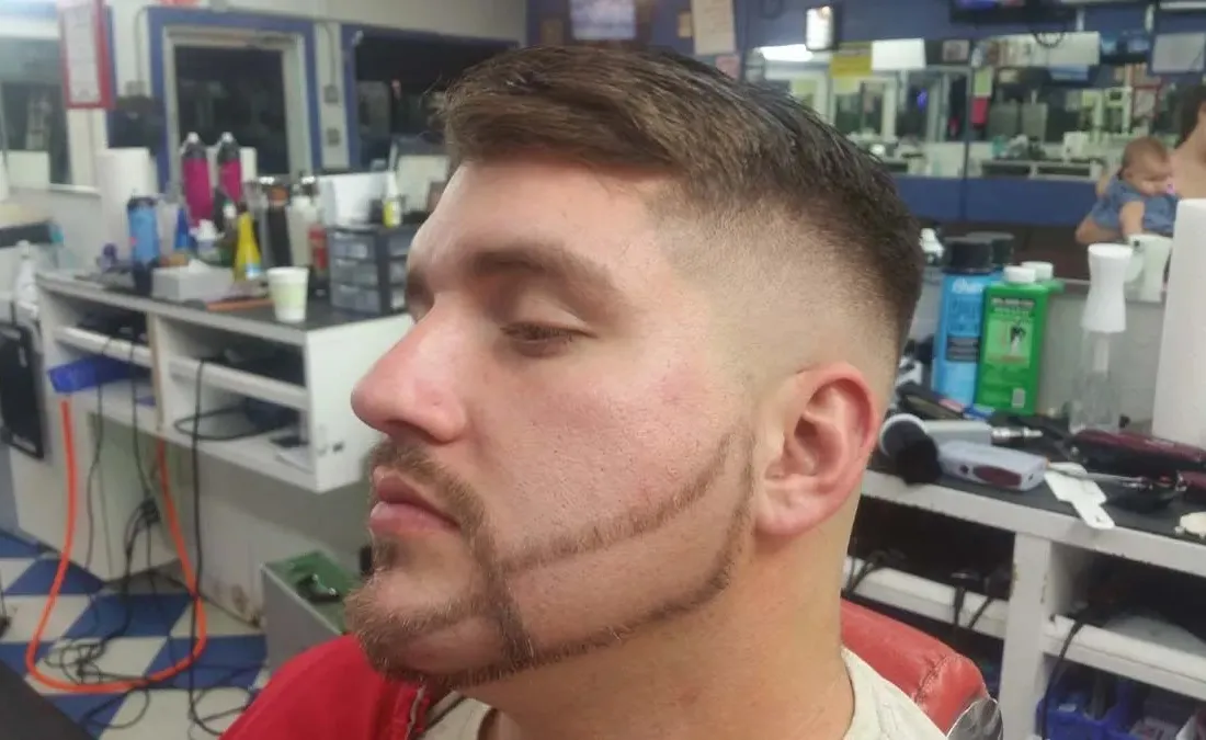 Beard lines
