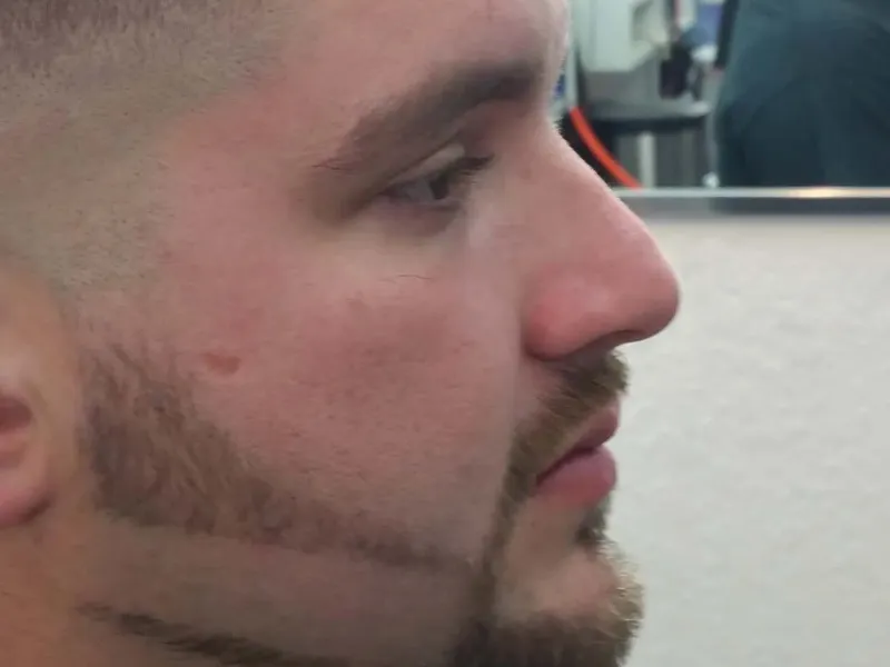 A finished beard line, close up